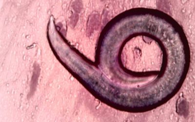 Ascaridioza – viermele cilindric parazit